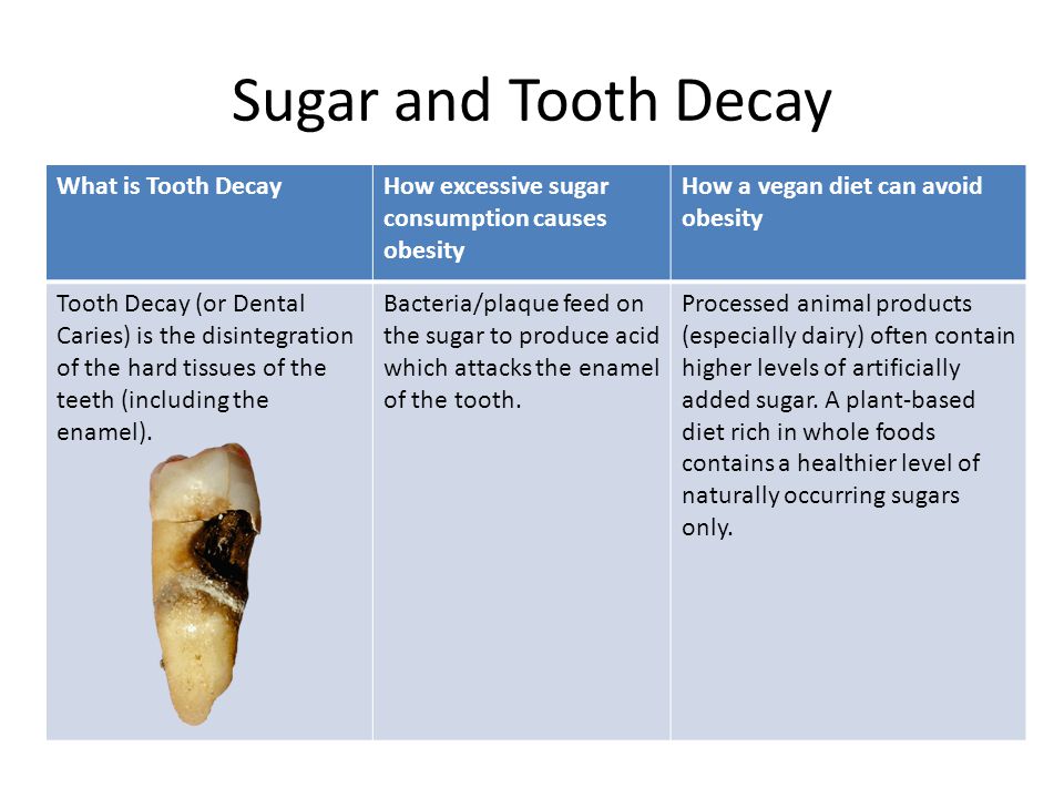 Sugar and Tooth Decay What is Tooth DecayHow excessive sugar consumption causes obesity How a vegan diet can avoid obesity Tooth Decay (or Dental Caries) is the disintegration of the hard tissues of the teeth (including the enamel).