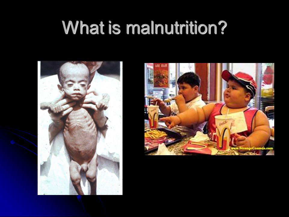What is malnutrition