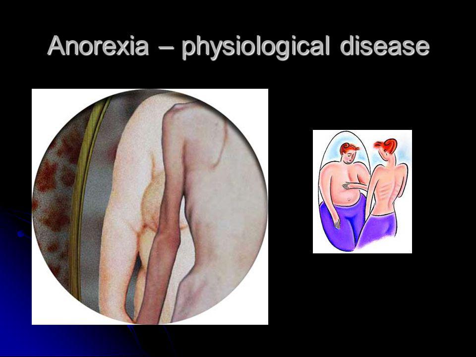Anorexia – physiological disease