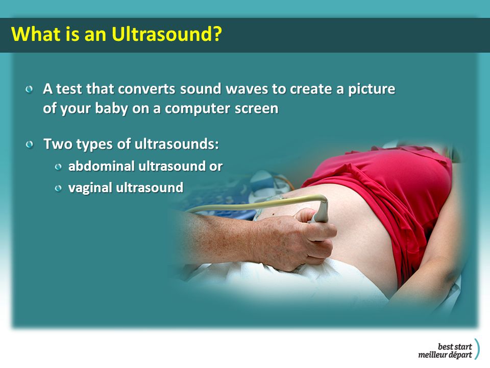 What is an Ultrasound.