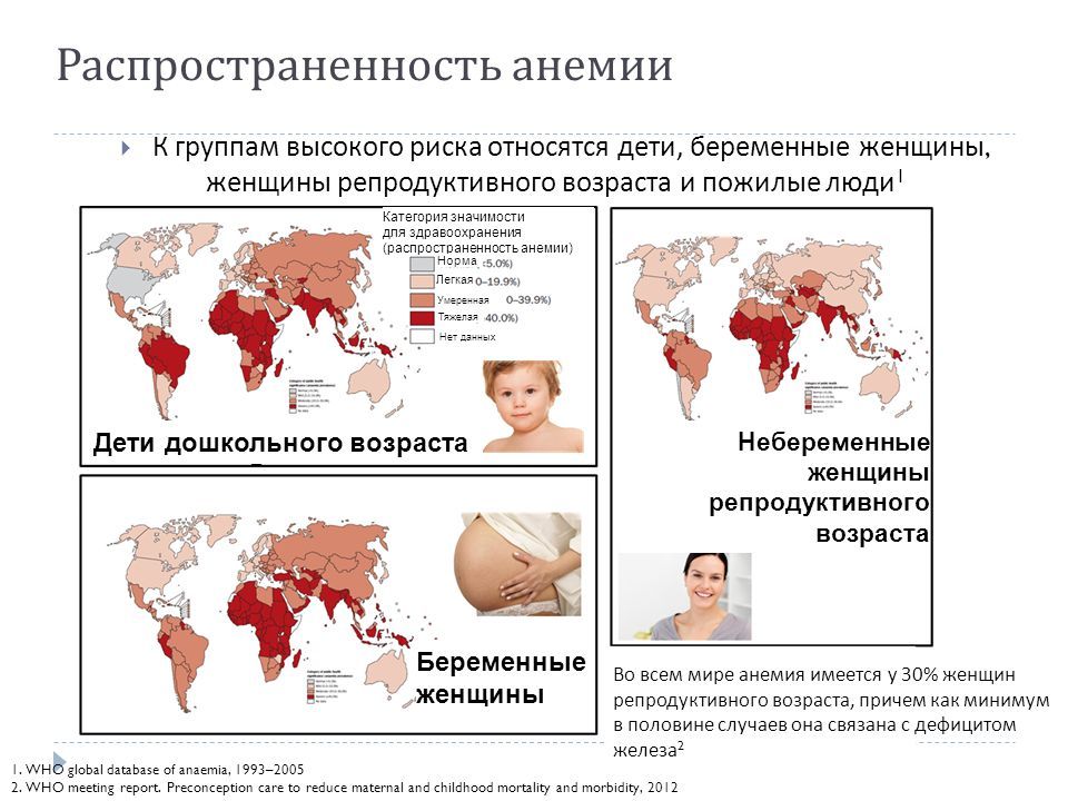Анемия 2022. Распространенность железодефицитной анемии в мире. Распространенность анемии по данным воз. Распространенность железодефицитной анемии в России. Показатели заболеваемости анемией в мире.