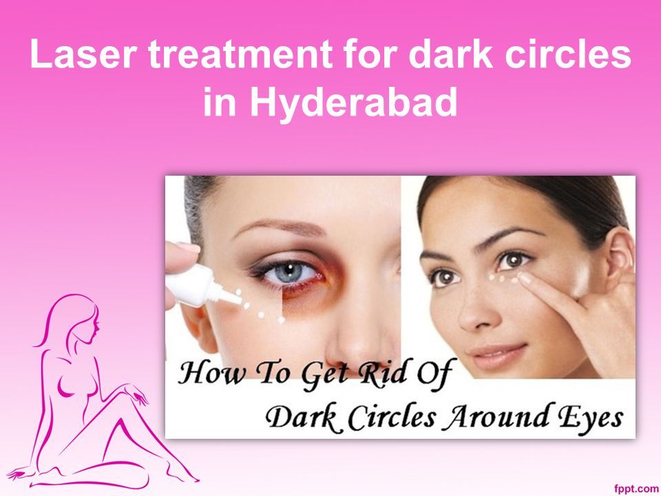 Looking For Under Eye Dark Circles Treatment ?. About Us Anoos,The best Hair  Saloon & Spa in Madinaguda, Hyderabad offers Haircare, Skincare, Body  massage, - ppt download