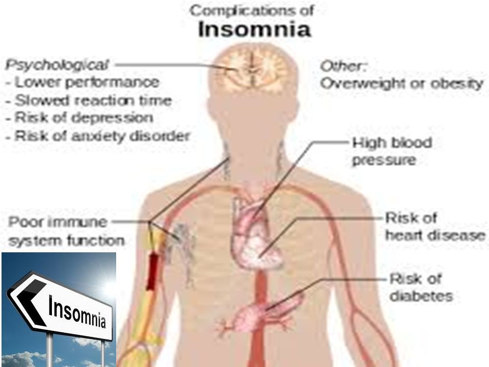 Medicinal Plants For Diseases Insominia A Series Of