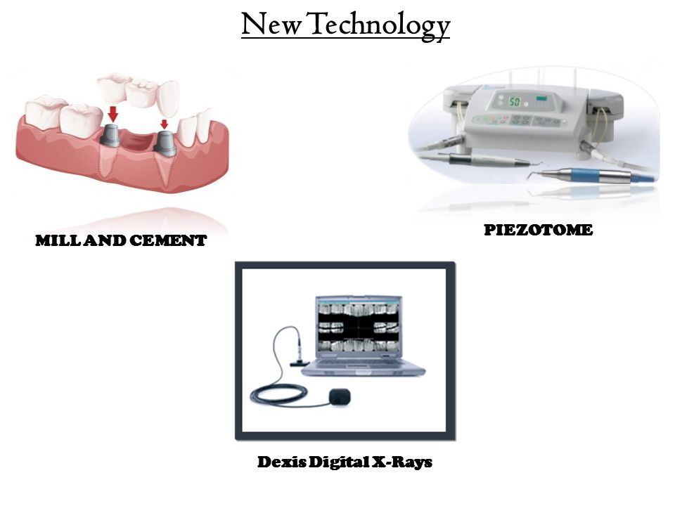 New Technology MILL AND CEMENT PIEZOTOME Dexis Digital X-Rays