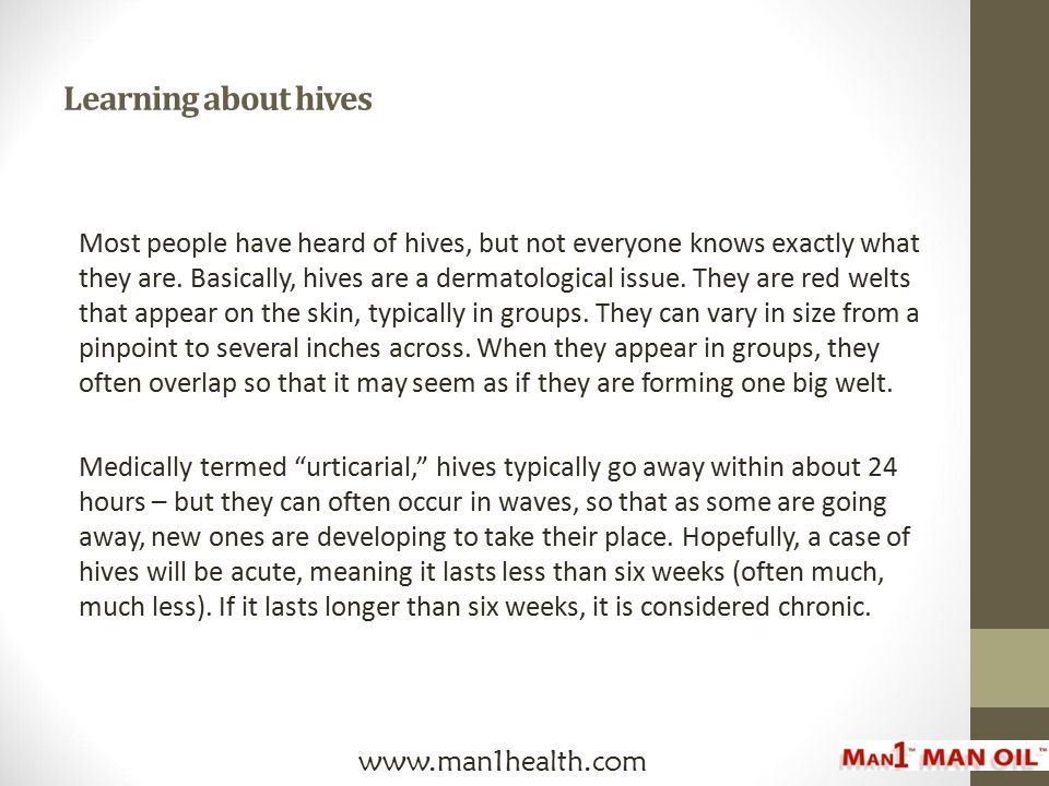 Learning about hives Most people have heard of hives, but not everyone knows exactly what they are.