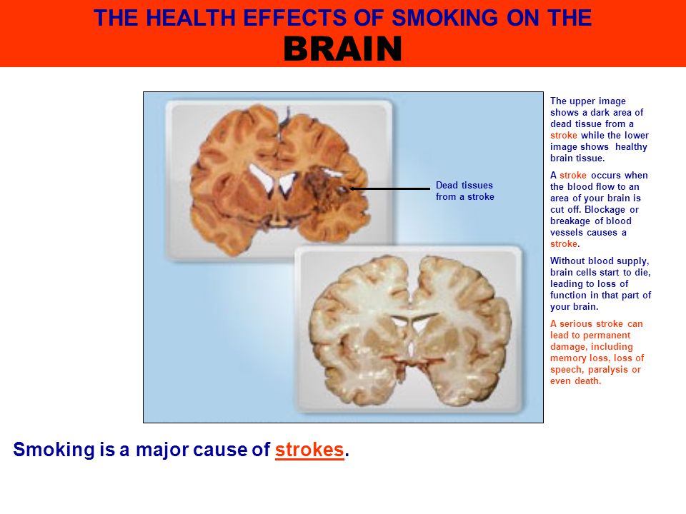 smoking is bad for health speech