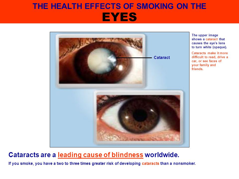 Smoking Is Harmful To Health Smoking Is Harmful To Health Ppt Download