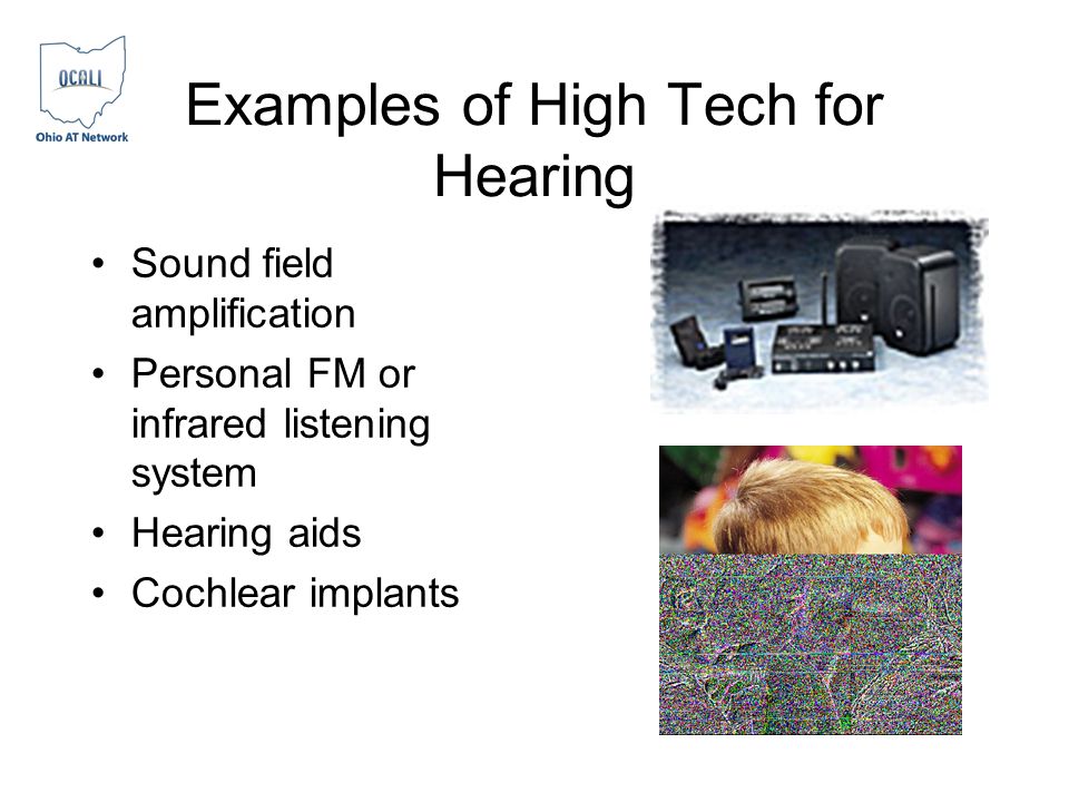 Examples of High Tech for Hearing Sound field amplification Personal FM or infrared listening system Hearing aids Cochlear implants