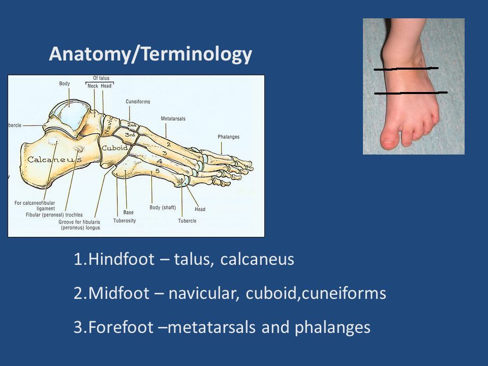 Common Pediatric Foot Deformities Clubfoot Congenital Talipes Equino Varus Ctev Ppt Download Common Pediatric Foot Deformities Clubfoot Congenital Talipes Equino Varus Ctev Ppt Download