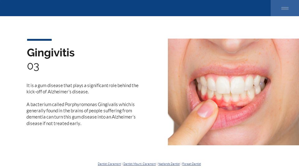 7 Best Reasons For Going To A Dentist Ppt Download