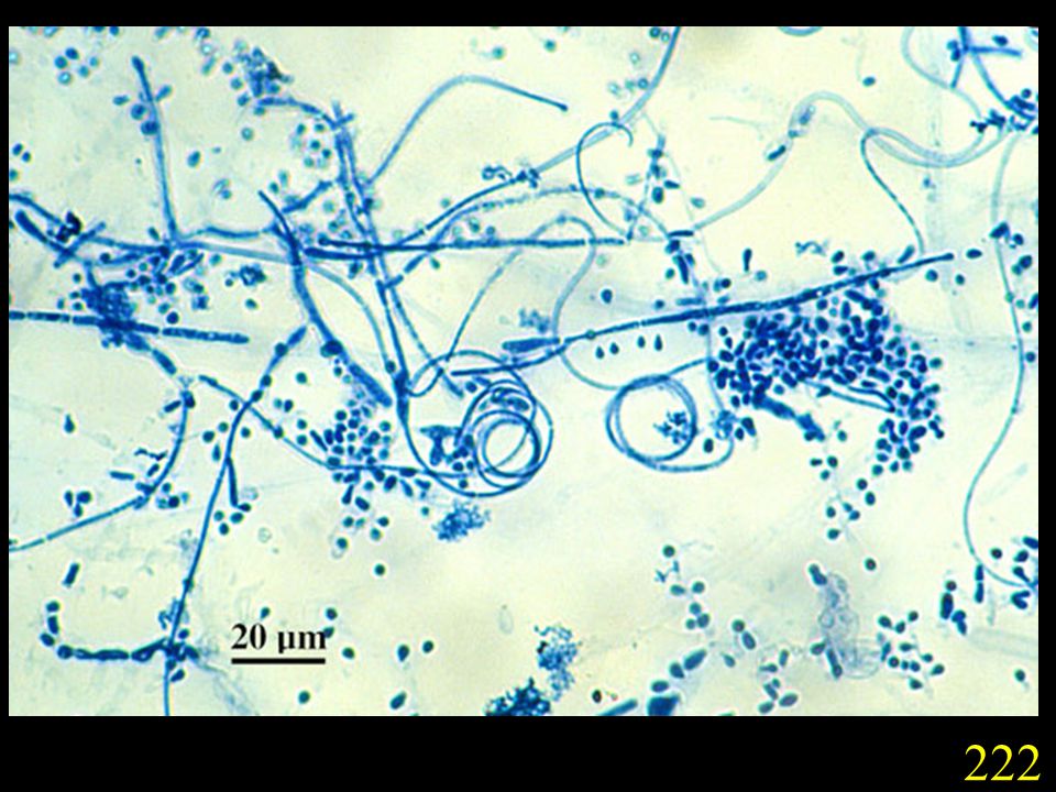 На коже обнаружены споры. Микроскопия Trichophyton rubrum. Trichophyton микроскопия. Грибы кандида микроскопия. Эпидермофития микроскопия.