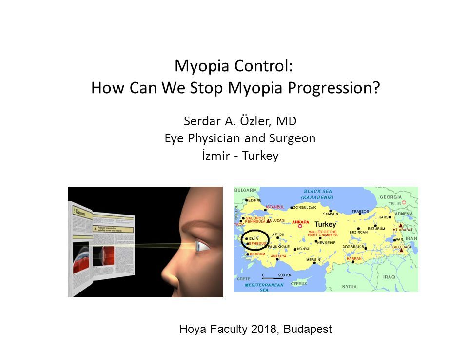 Myopia Control: How Can We Stop Myopia Progression.
