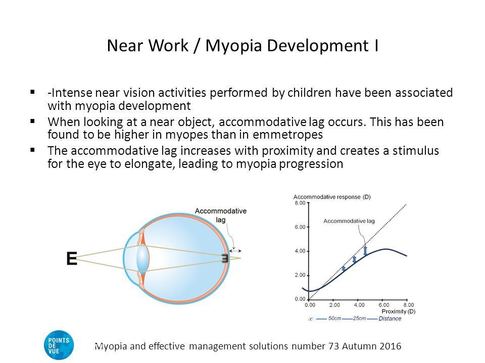 Near Work / Myopia Development I  -Intense near vision activities performed by children have been associated with myopia development  When looking at a near object, accommodative lag occurs.