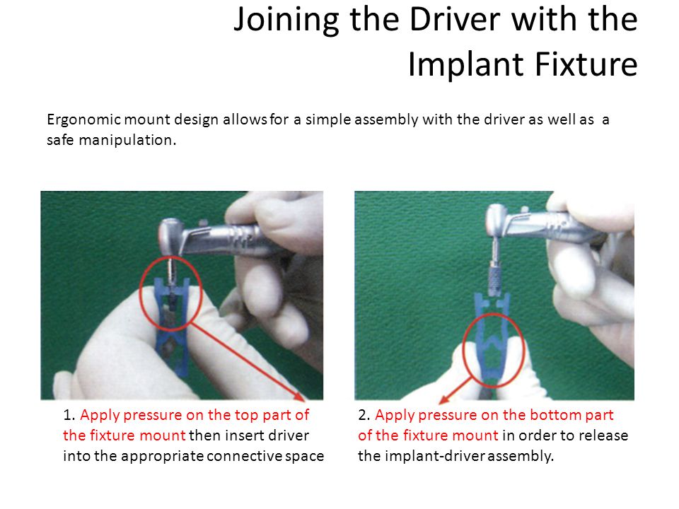 Joining the Driver with the Implant Fixture 1.