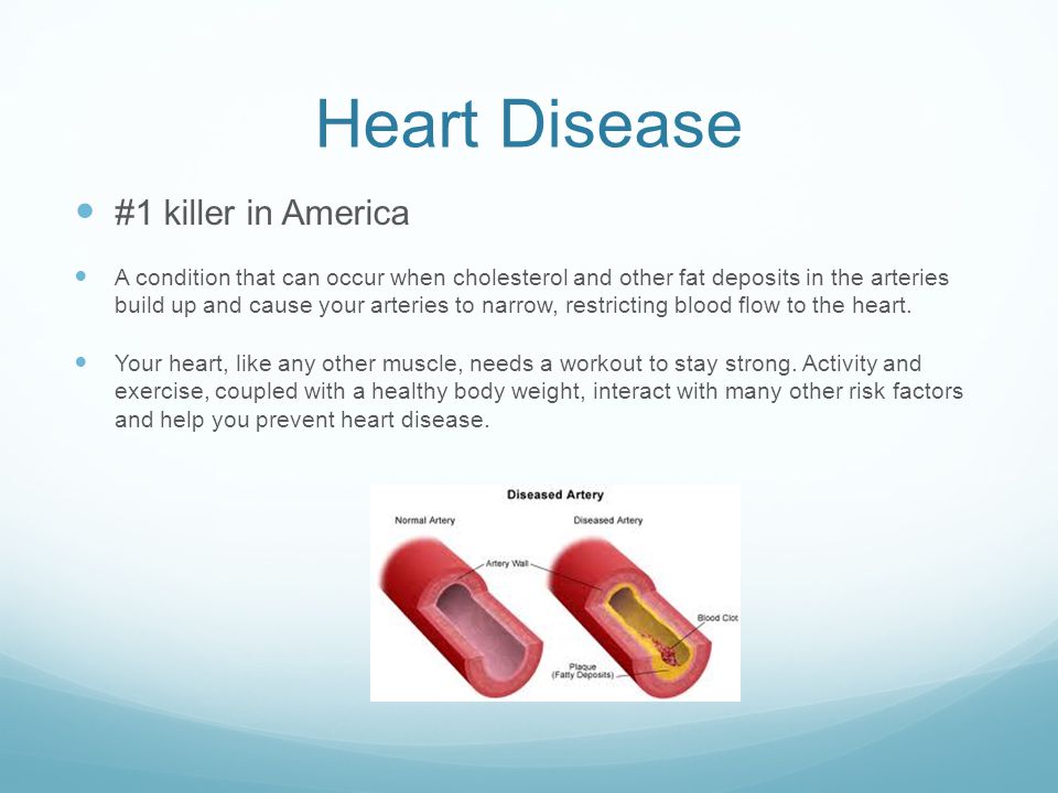 Heart Disease #1 killer in America A condition that can occur when cholesterol and other fat deposits in the arteries build up and cause your arteries to narrow, restricting blood flow to the heart.