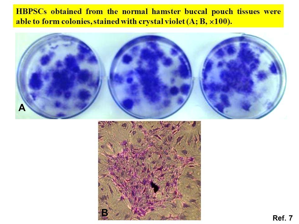 A B HBPSCs obtained from the normal hamster buccal pouch tissues were able to form colonies, stained with crystal violet (A; B,  100).