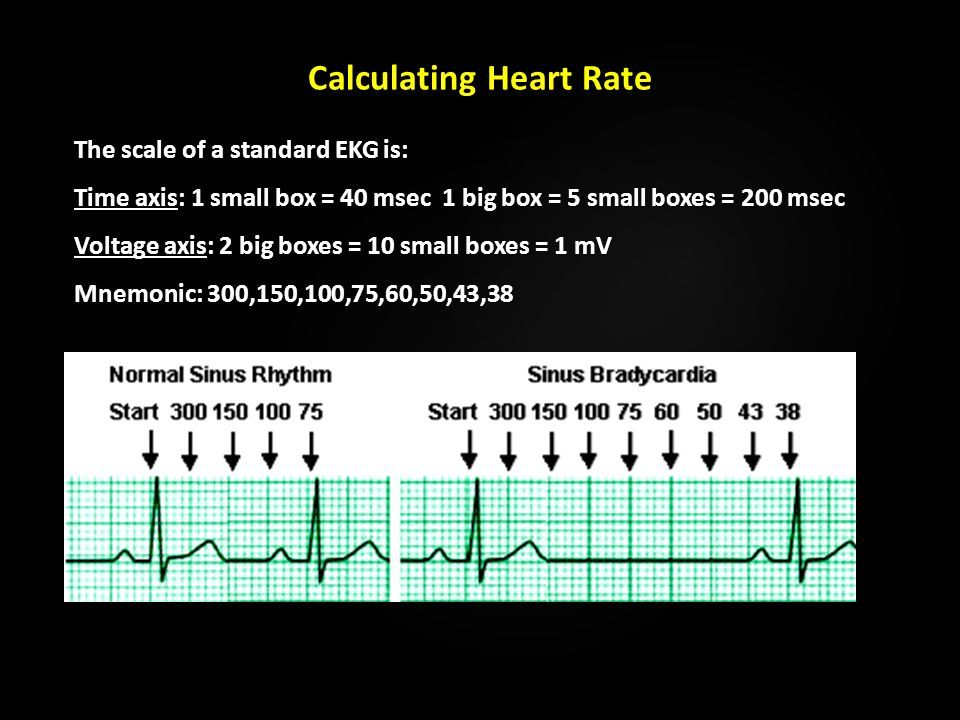 Introduction to the Mechanical & Electrical Properties of the Heart A ...